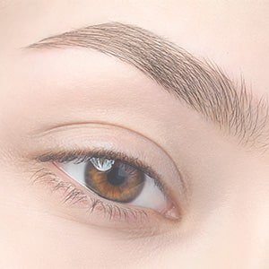 Information sur la blépharoplastie à Carcassonne